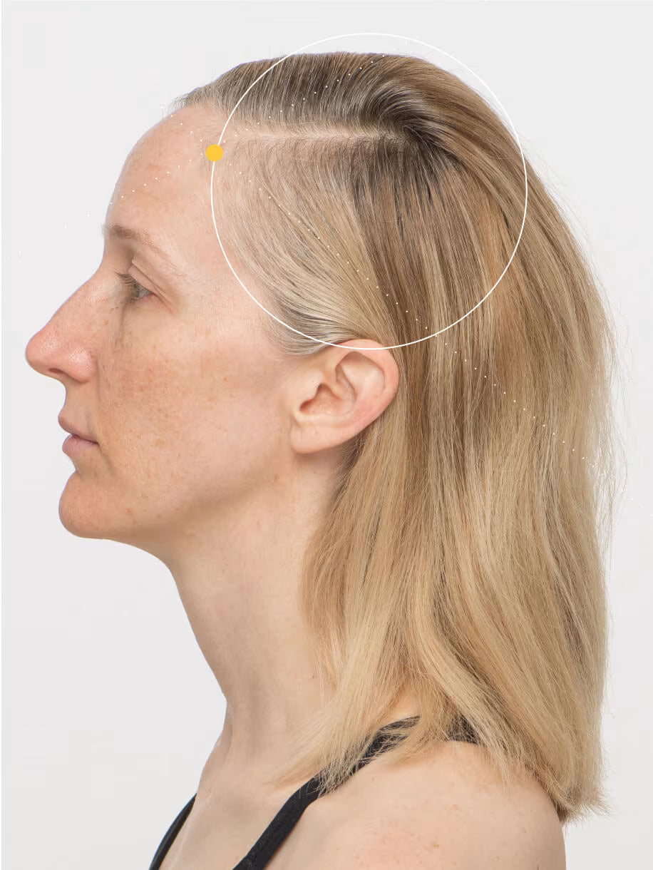 After: Tanya