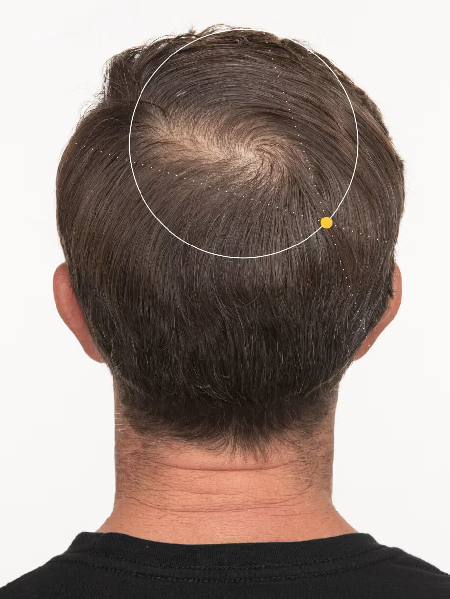 Before: Mark